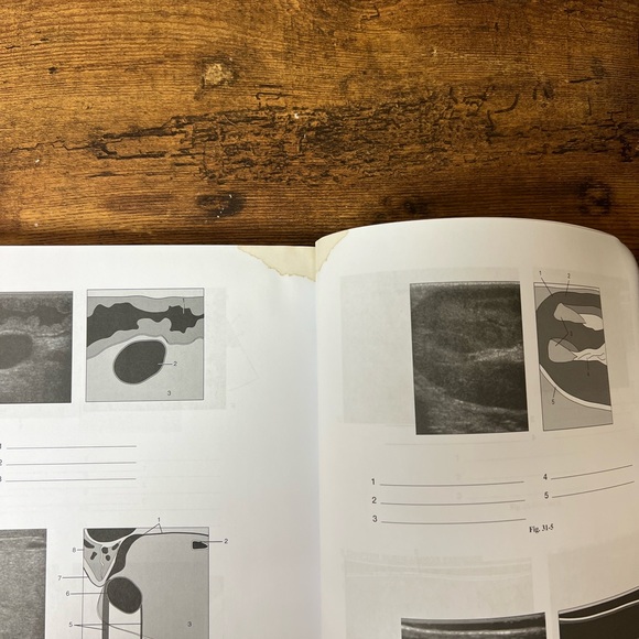 Sonography Introduction to Normal Structure and function Workbook and Lab manual - Picture 5 of 7
